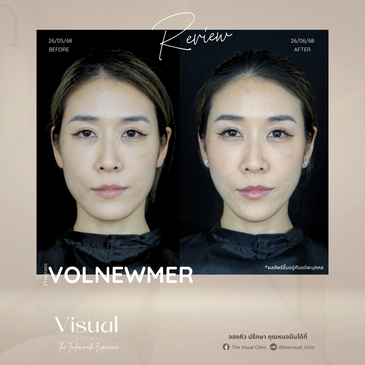 Program Volnewmer