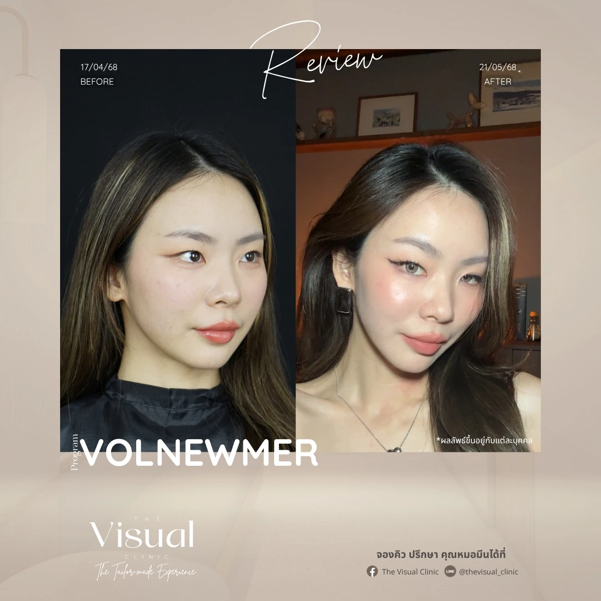 Program Volnewmer