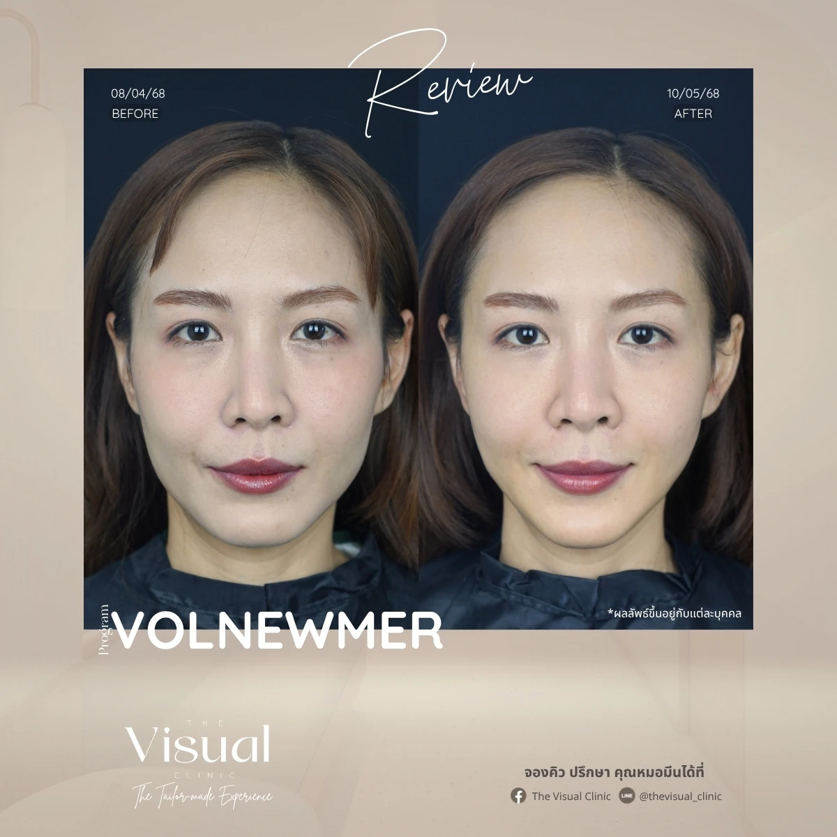Program Volnewmer