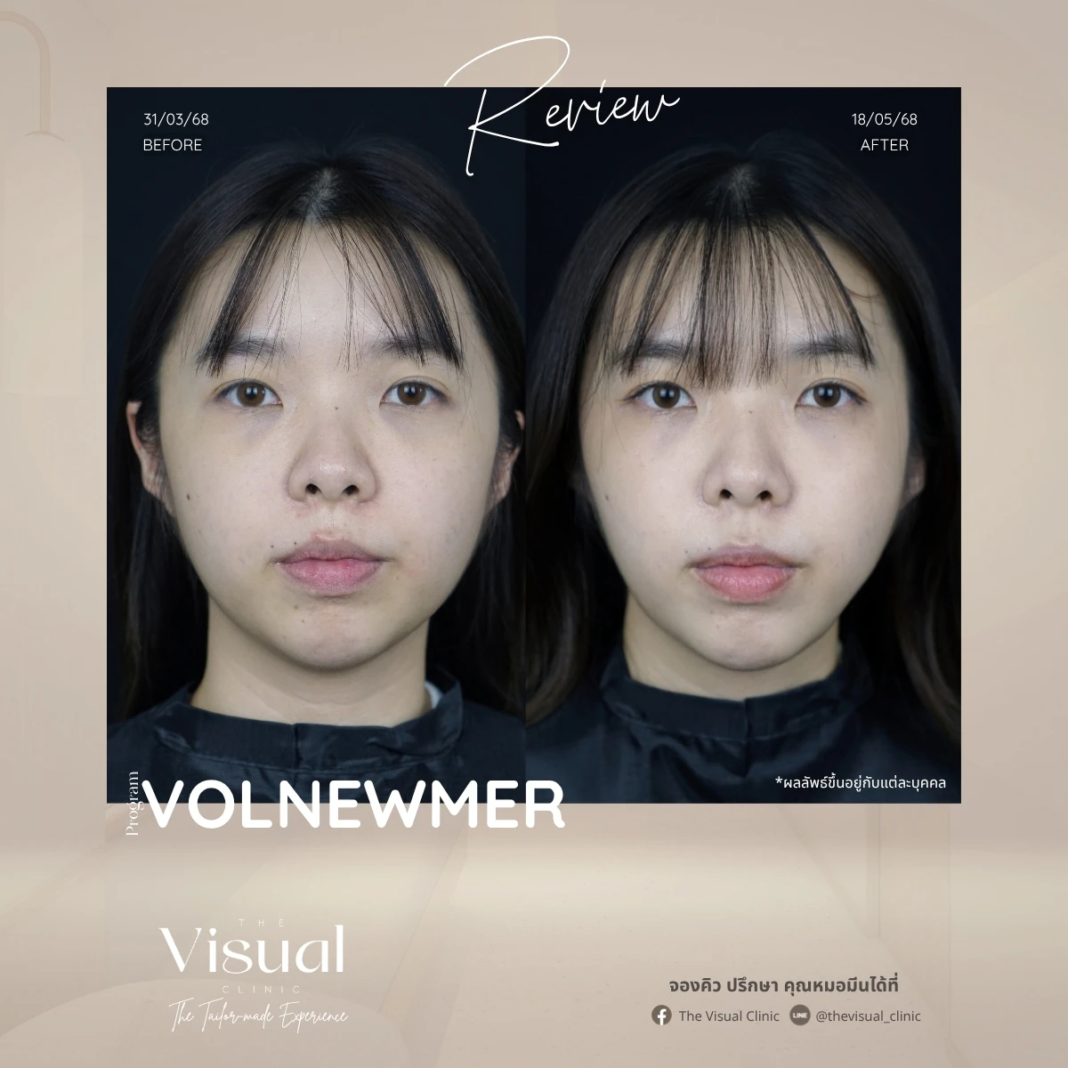 Program Volnewmer