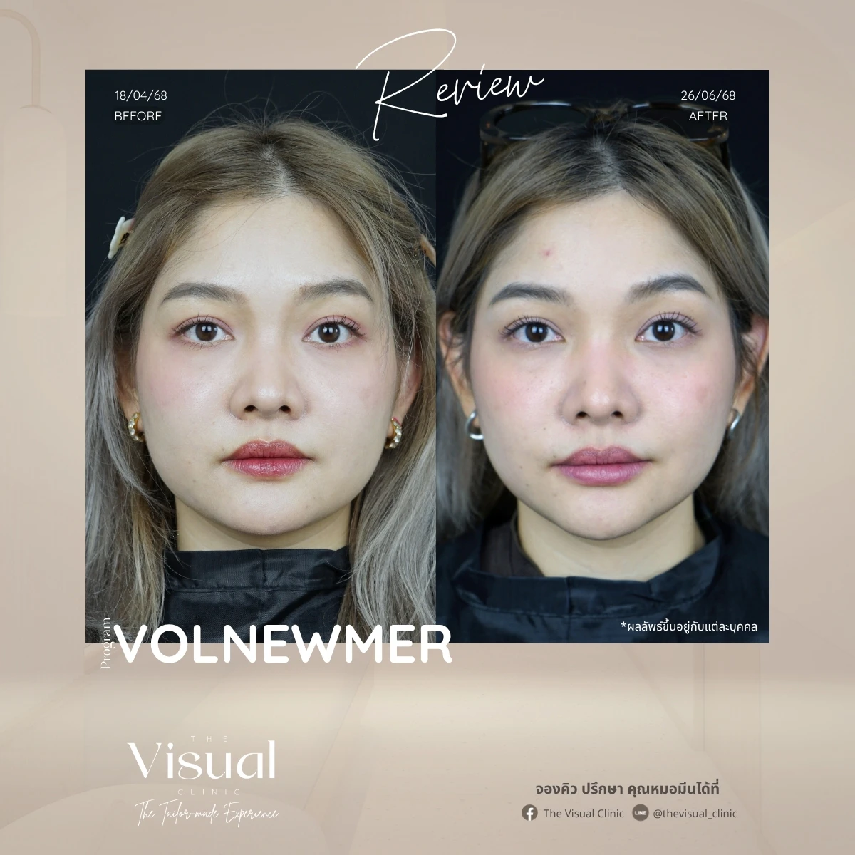 Program Volnewmer