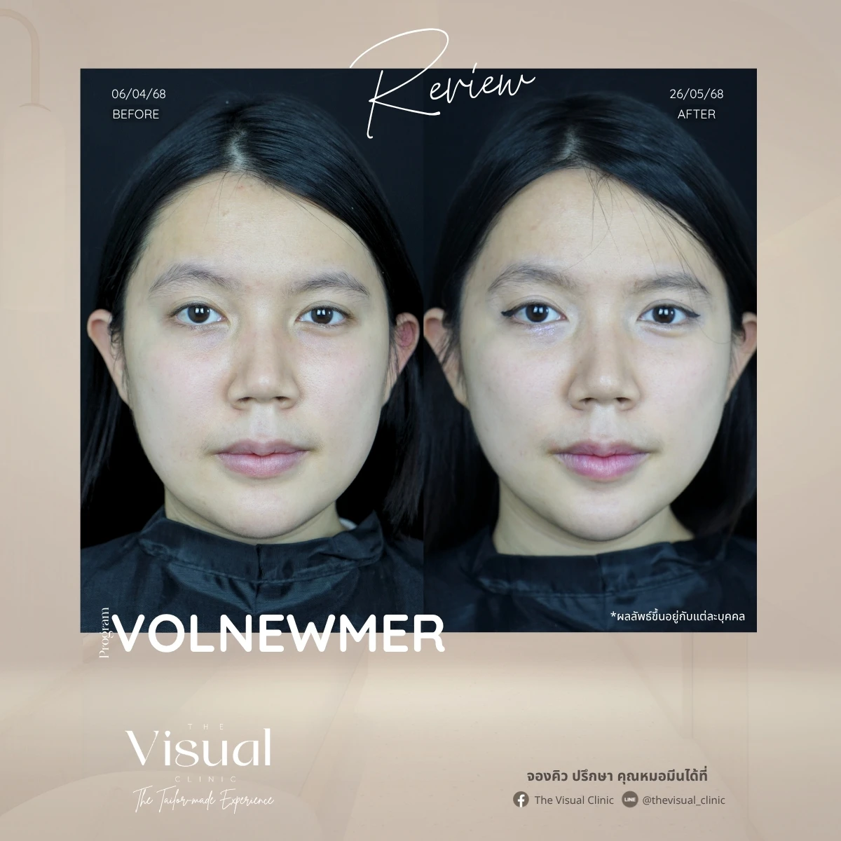 Program Volnewmer