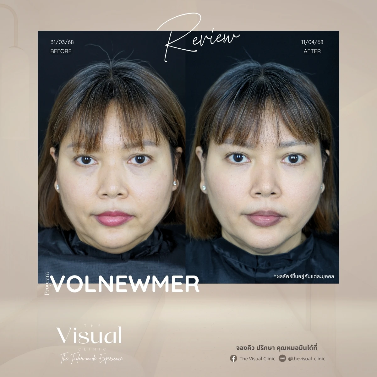 Program Volnewmer